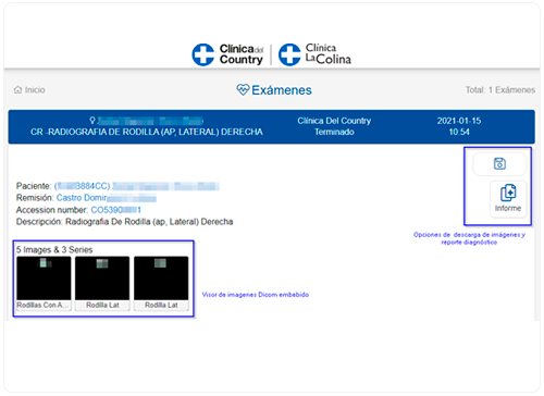 Consulta de resultados